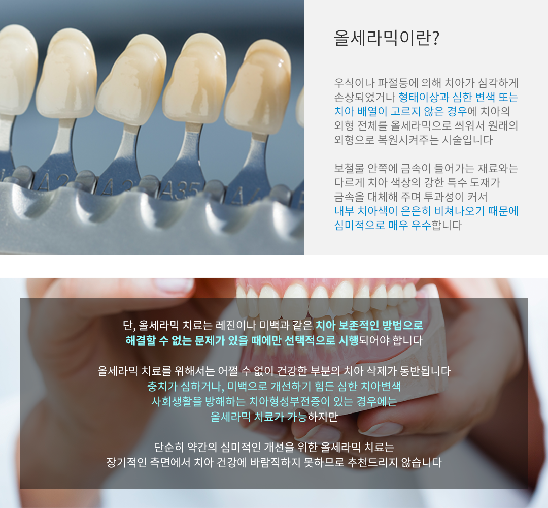 올세라믹이란?