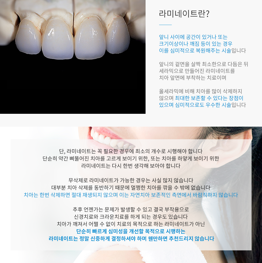 라미네이트란?