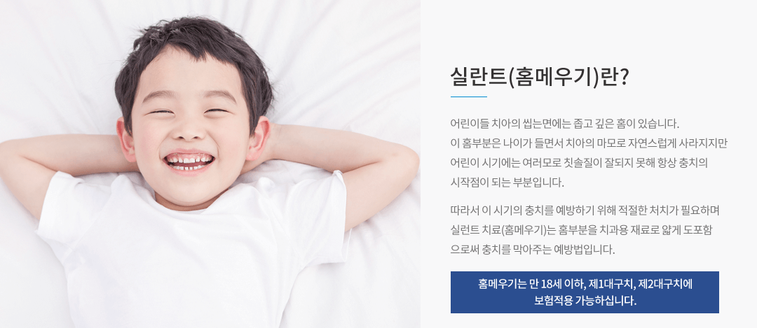 실란트(홈메우기)란?
