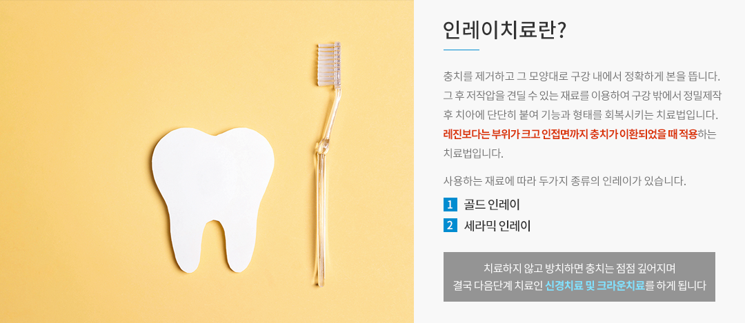 인레이치료란?