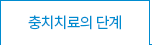충치치료의단계