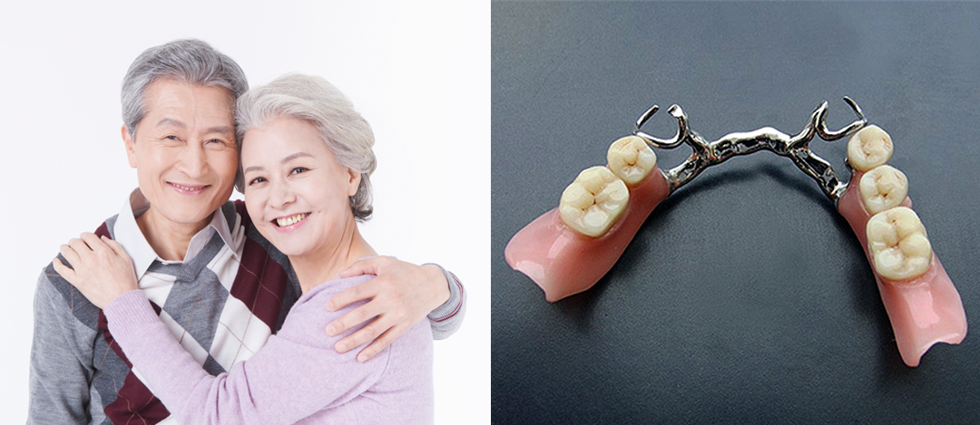 부분틀니