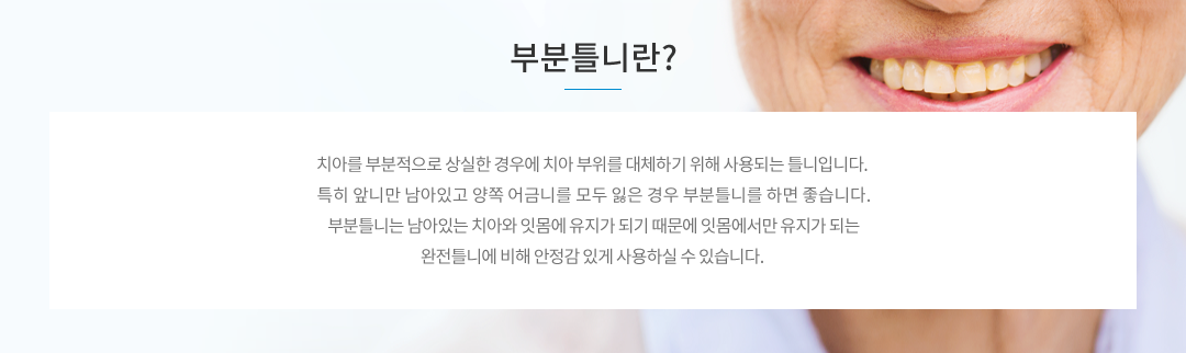 부분틀니란?