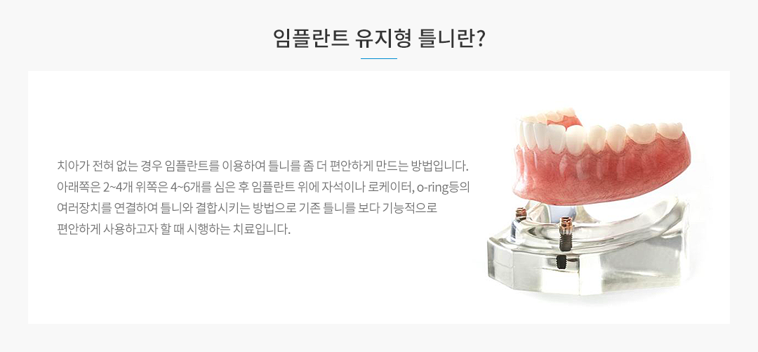 임플란트 유지형 틀니란?