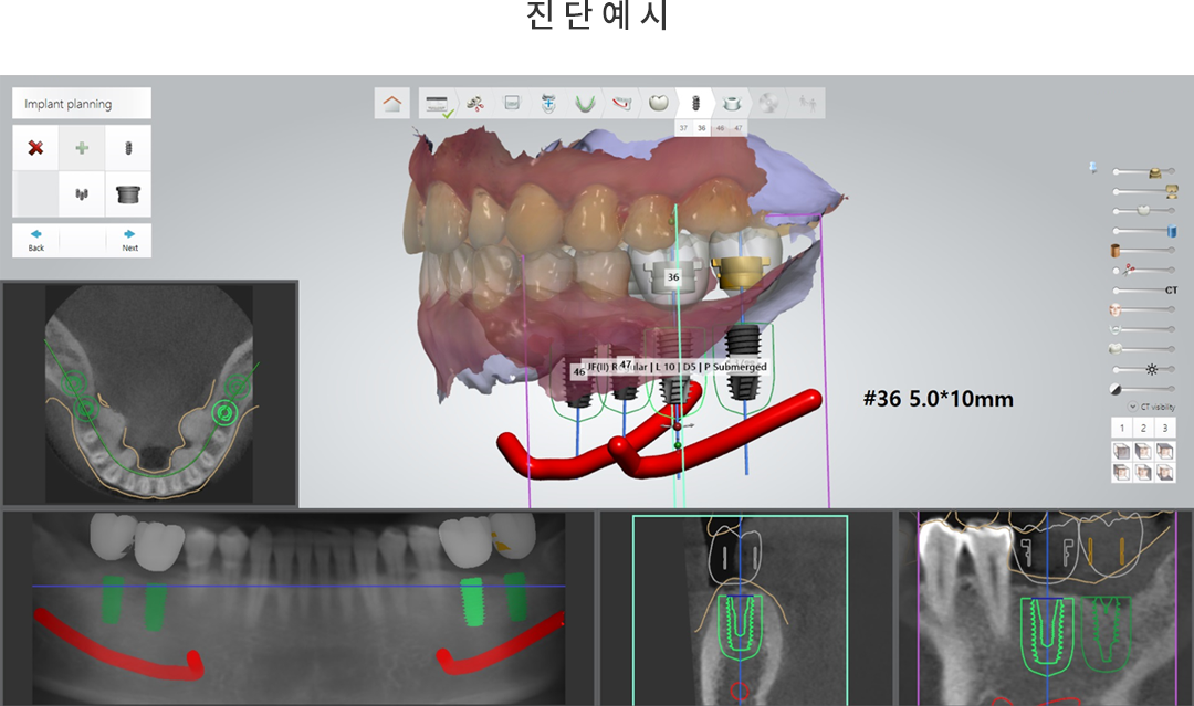 진단예시