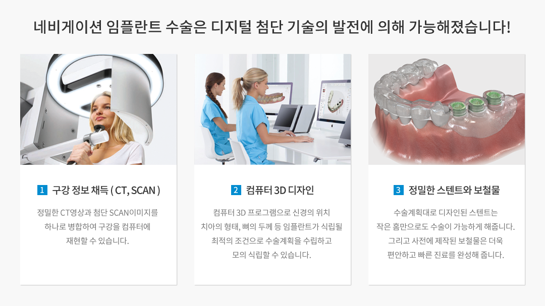 네비게이션 임플란트 수술은 디지털 첨단 기술의 발전에 의해 가능해졌습니다! 