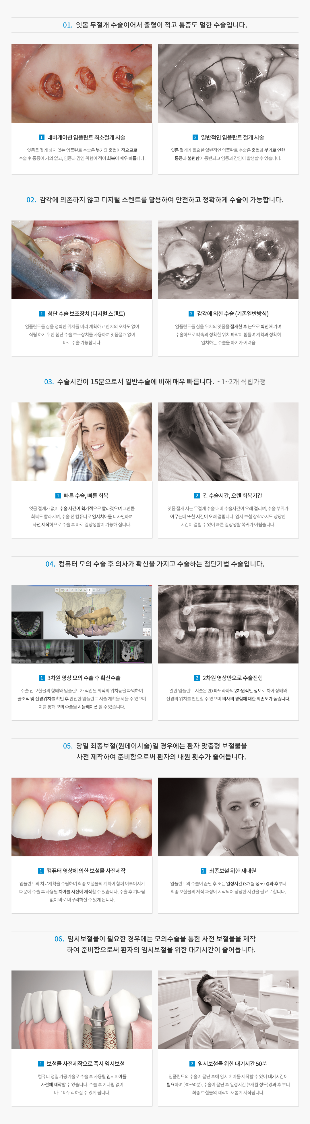 네비게이션임플란트 수술 장면