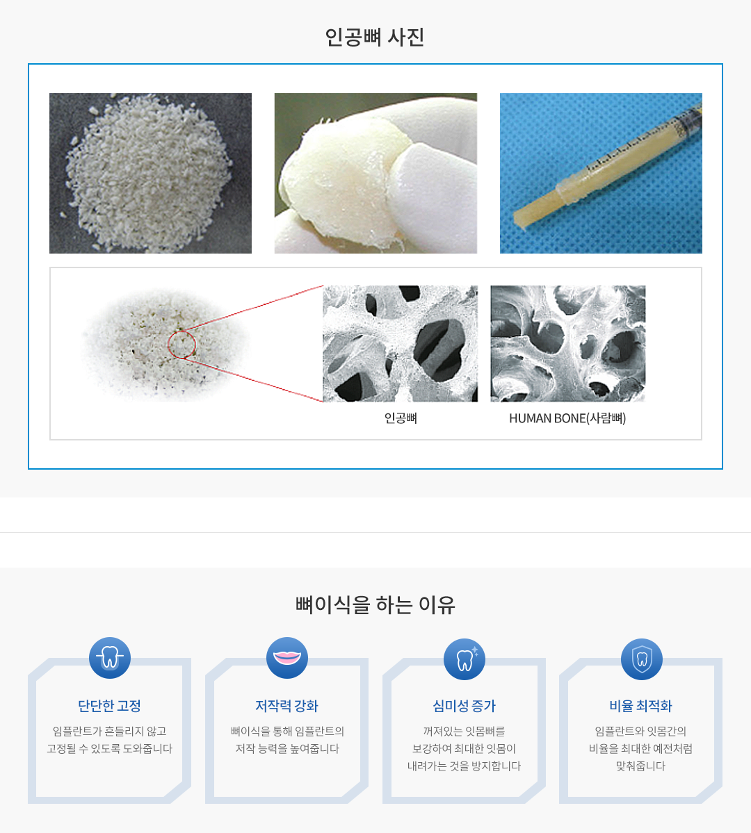 인공뼈 사진