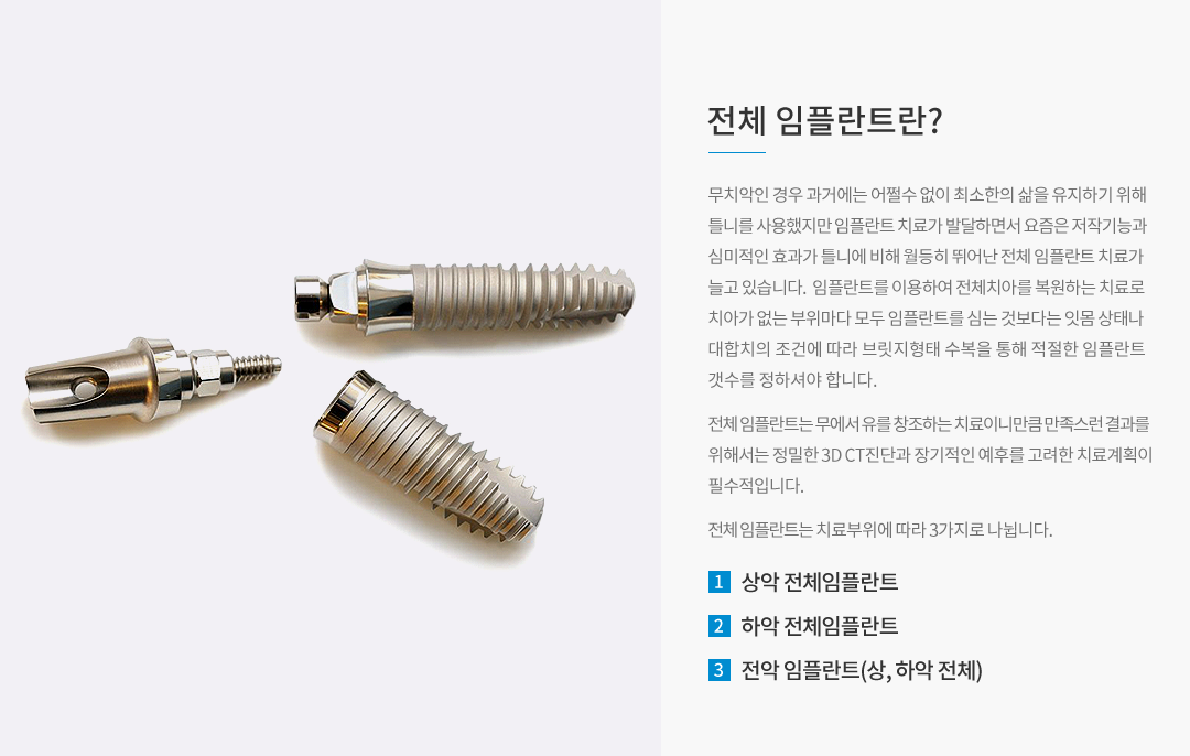 전체 임플란트란?
