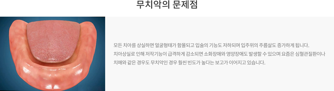 무치악의 문제점