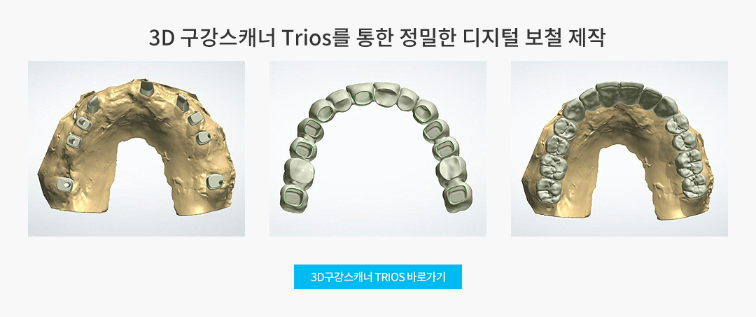 3D구강스캐너 TRIOS를 통한 정밀한 디지털 보철 제작