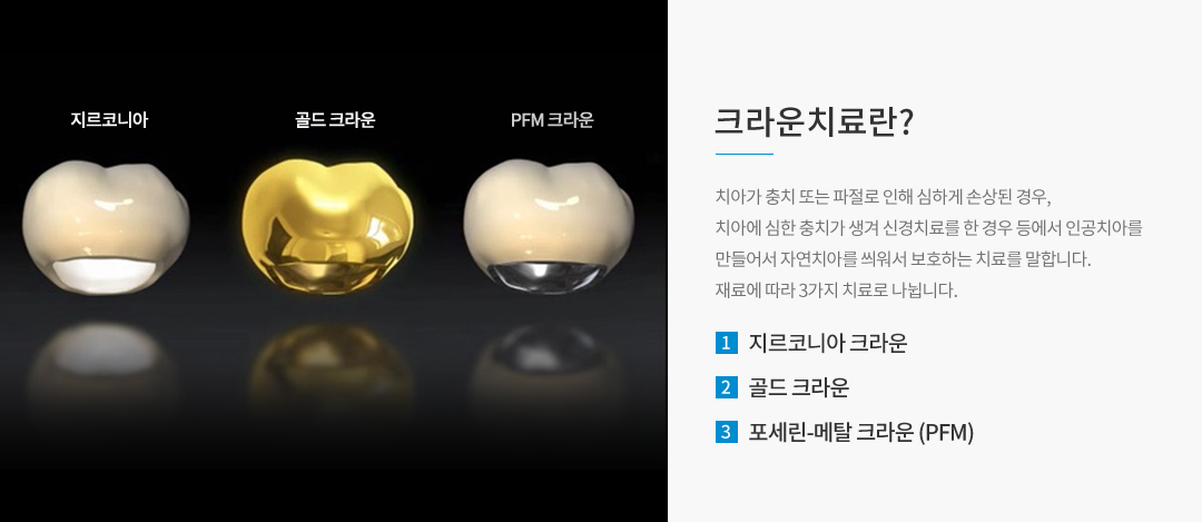 크라운치료란?