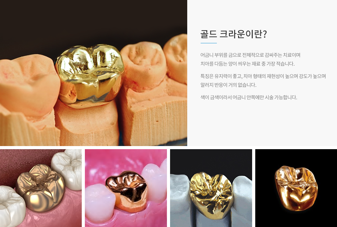 골드 크라운이란?