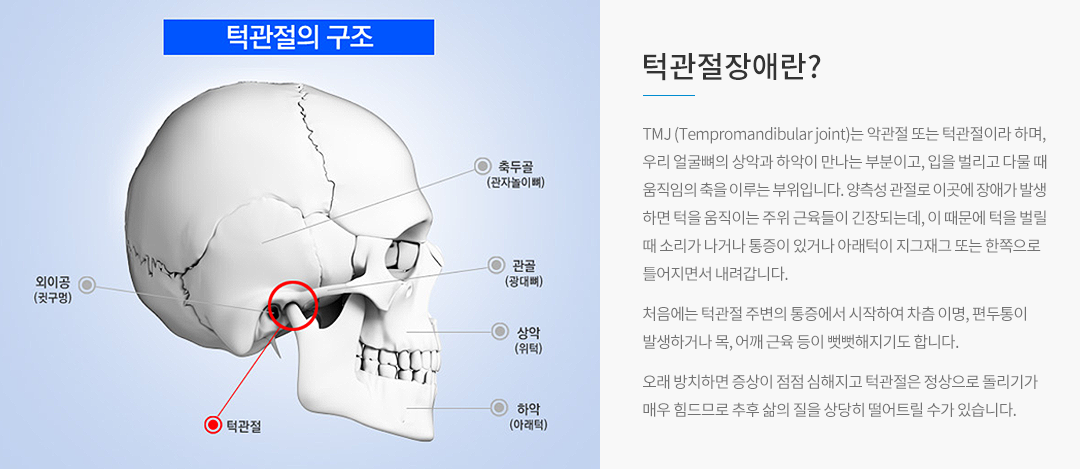 턱관절장애란?