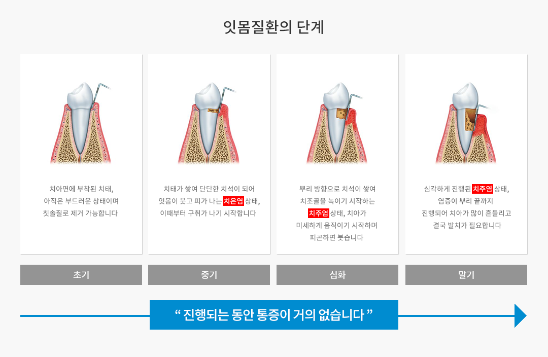 잇몸질환의 단계