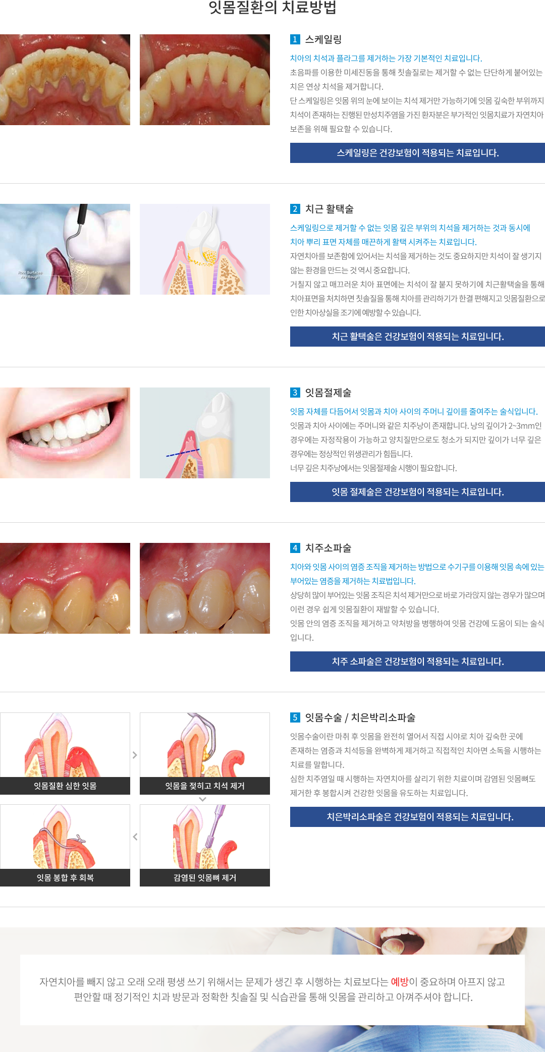 잇몸질환의 치료방법 : 스케일링, 치근활택술, 잇몸절제술, 치주소파술, 잇몸수술 및 치주수술 순으로 진행되며, 잇몸 봉합 후 일정기간 회복기간을 거친 후 정기적인 체크 및 유지관리가 필요합니다.