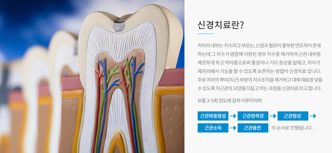 신경치료란?