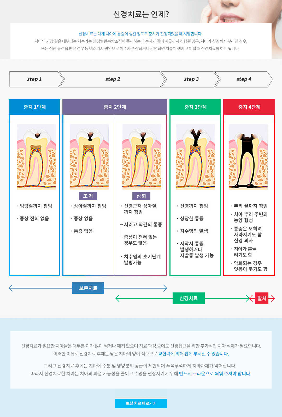 신경치료는 언제?